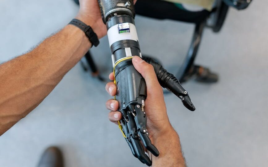 person holding prosthetic arm